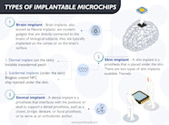 Rfid Microchips In Humans At Brandon Myers Blog
