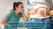 Norovirus Symptoms Causes Treatment And Prevention Sprint Medical