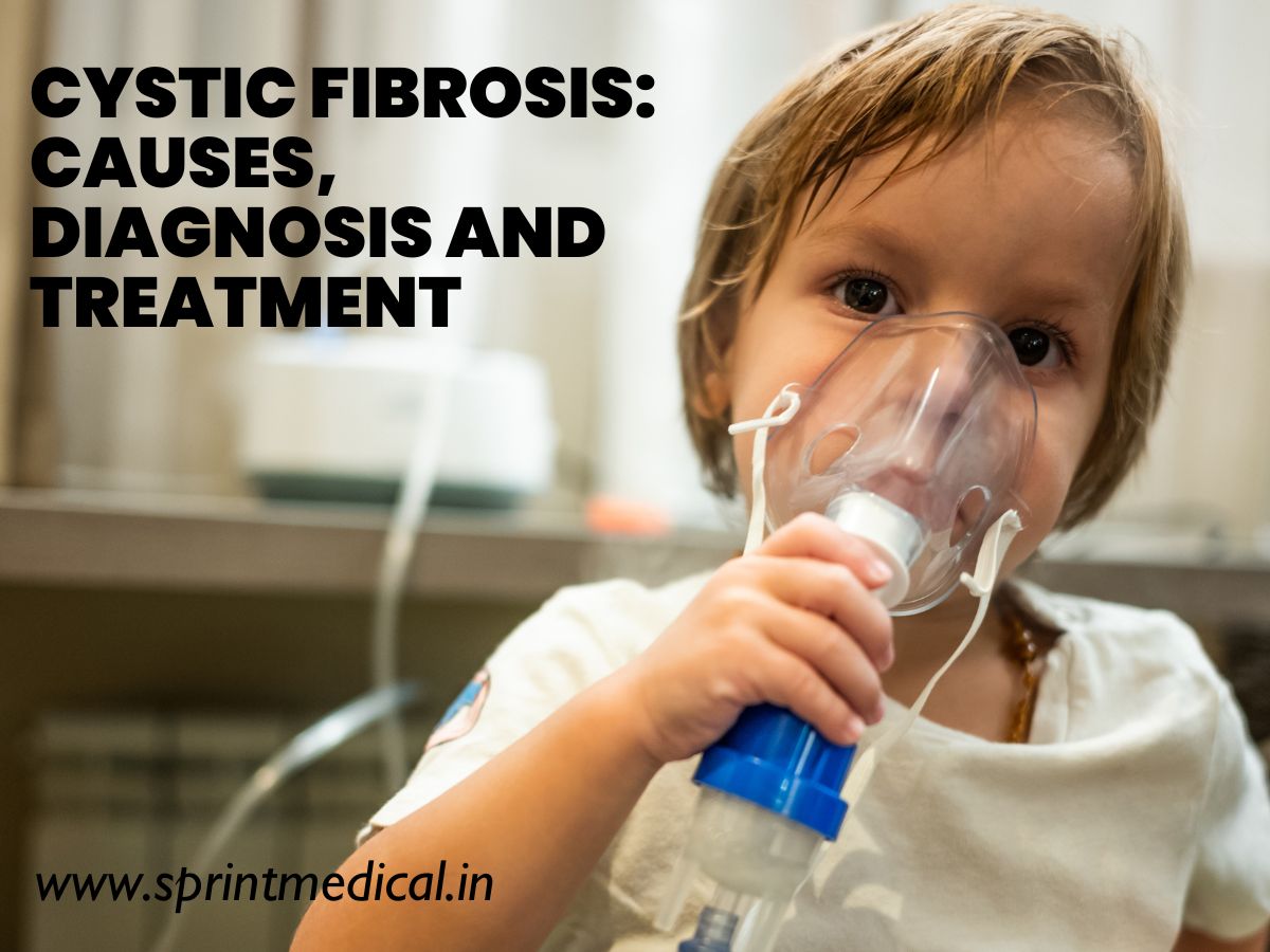 Cystic Fibrosis Causes, Diagnosis and Treatment