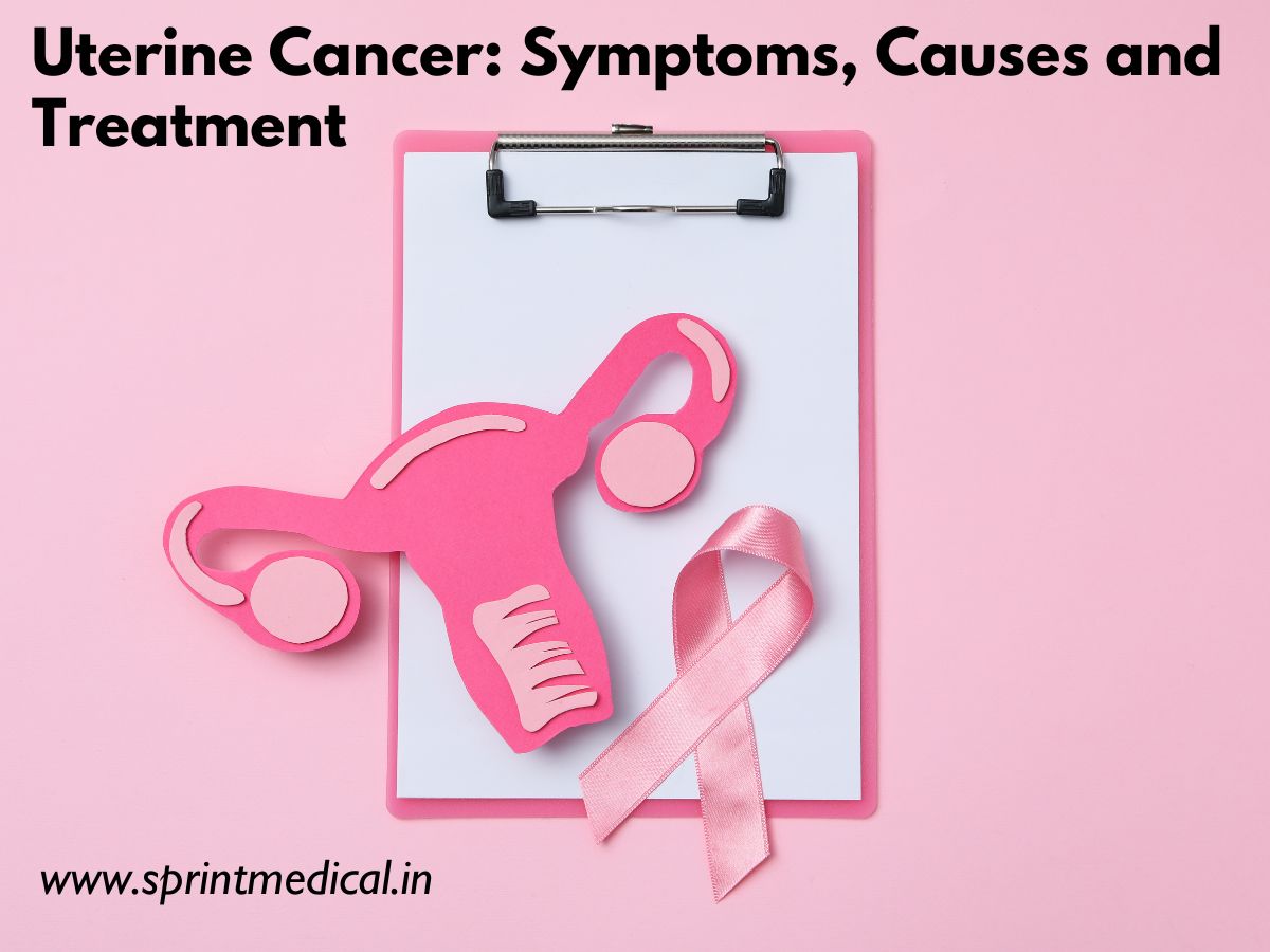 Uterine Cancer (Endometrial Cancer) Symptoms, Causes and Treatment