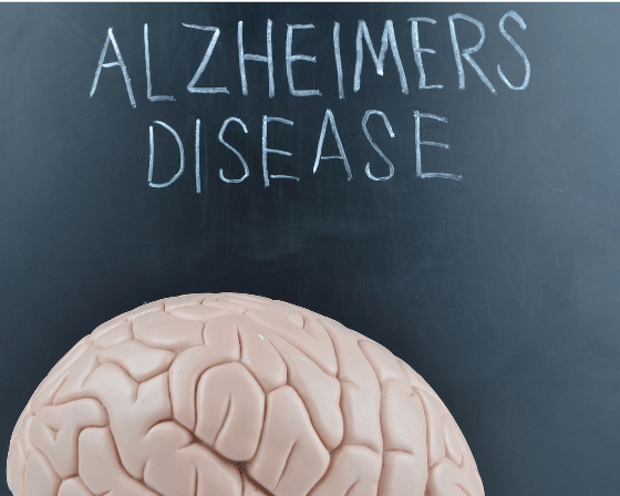 How to treat Alzheimer’s Disease