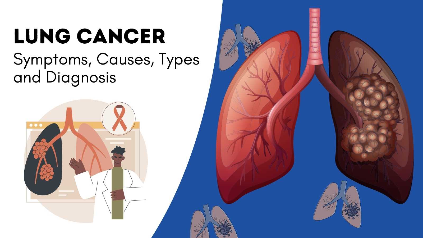 Lung Cancer Symptoms, Causes, Types and Diagnosis