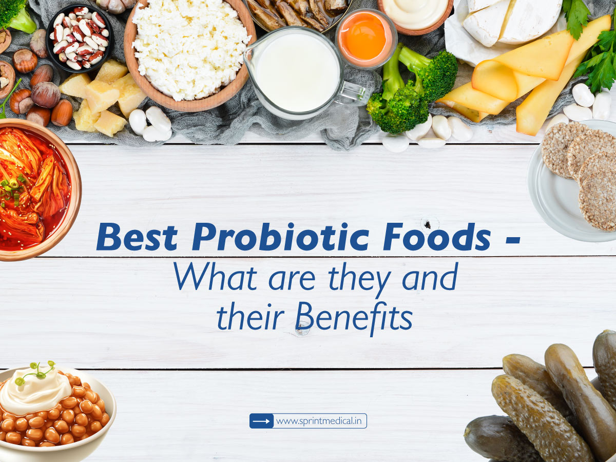 What-are-the-best-probiotic-foods-Feature-image-