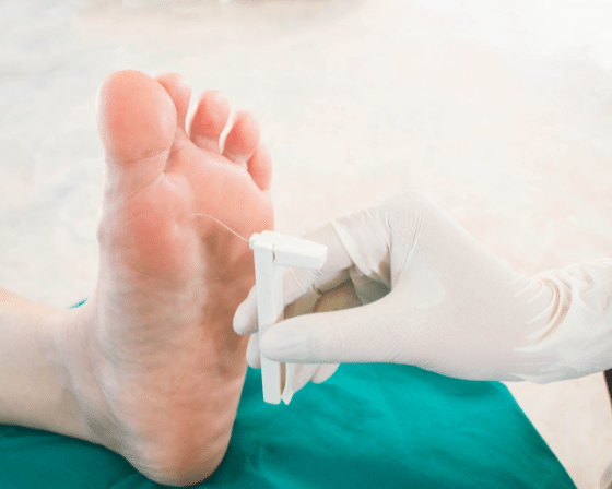 HOME REMEDIES FOR PERIPHERAL NEUROPATHY