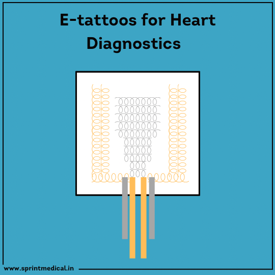 E-Tattoos For Heart Diagnostics