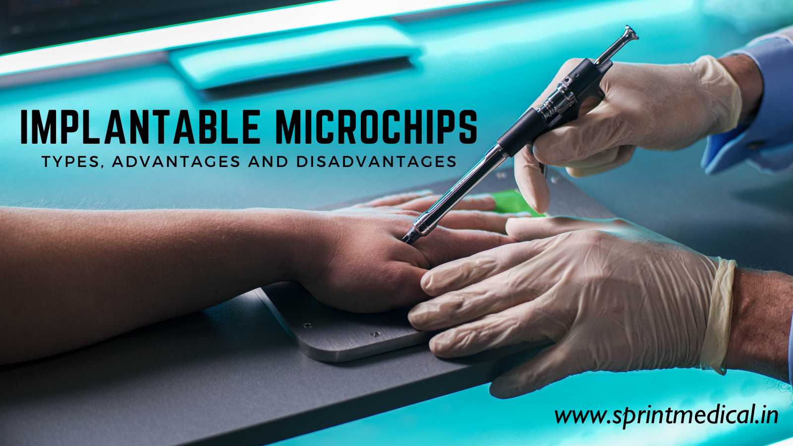 Implantable Microchips Types, Advantages and Disadvantages