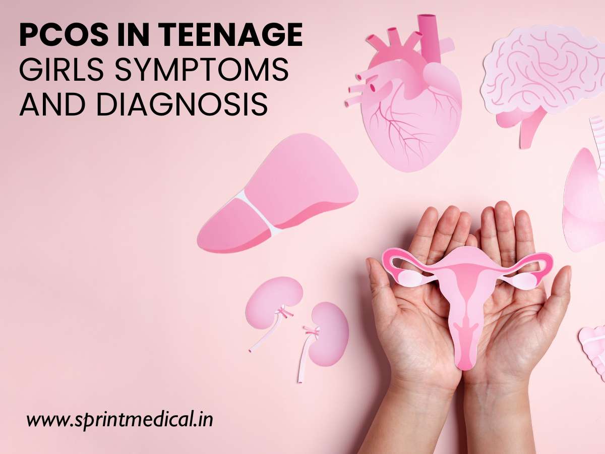 PCOS in Teenage Girls: Symptoms and Diagnosis