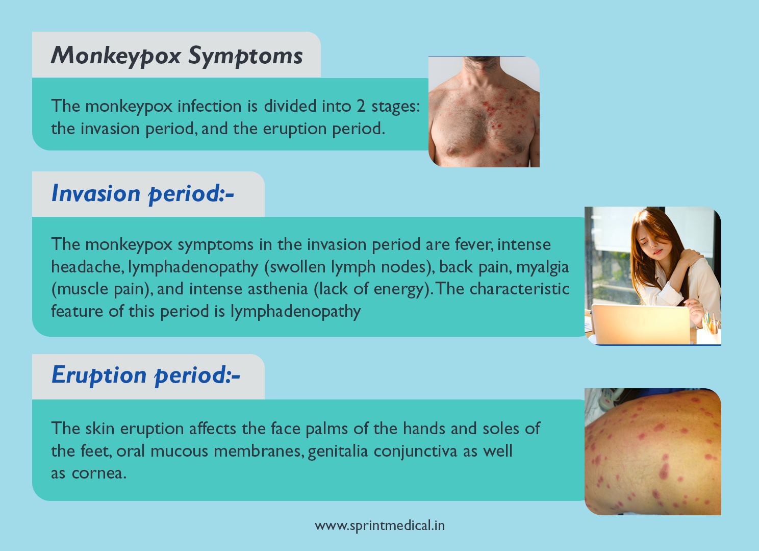 Monkeypox Symptoms