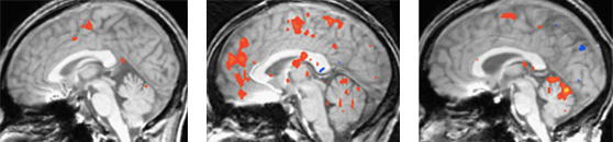2013-12-01-udl-brain-1428752713-1428758591.jpg