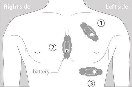 HealthPatch - healthcare biosensor wearable technology