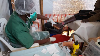 Traitement de plaies ulcéreuses par Médecins Sans Frontières - © MSF Belgique