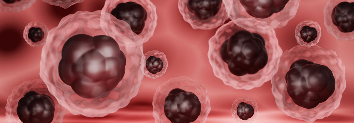 Una investigación arroja luz sobre la relación entre los virus de la influenza y el SARS-CoV-2, la inflamación que producen, y el despertar de células cancerosas dormidas.