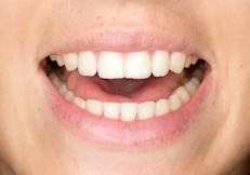 Inhala y exhala haciendo un fuerte sonido "Mmmmmm " con los labios apretados. Luego abre la boca bien grande mientras dices "Ahhhh" con la lengua pegada a los dientes inferiores. Haz 10 repeticiones, tres veces al día. Esta es una sencilla manera de ejercitar los músculos y evitar que se atrofien.