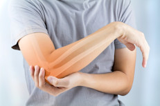 El exceso de peso también contribuye a la aparición de la artritis. El riesgo de por vida de padecer artritis para las personas obesas es del 47%, frente al 36% para las personas no obesas, encontró un estudio.