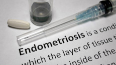 La endometriosis se produce cuando el tejido celular que está dentro del útero comienza a crecer, se esparce fuera de la cavidad uterina y se dispersa por los ovarios, las trompas de Falopio, los intestinos, el recto, la vejiga y el revestimiento de la zona pélvica.
