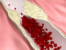 La Administración de Drogas y Alimentos (FDA, su sigla en inglés) reconoció en 1997 que el B‑glucano de avena, una fibra dietética soluble que se encuentra en el grano puede reducir los niveles de colesterol, por lo que emitió una regulación que permitió registrar las hojuelas de avena como el primer alimento reductor del colesterol en una cantidad de 3 gramos al día.