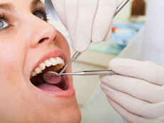 La periodontitis es una infección en las encías y en el hueso que sujeta los dientes. En casos de infección grave, las encías pueden separarse de los dientes, haciéndolos parecer más largos. Los primeros signos son enrojecimiento, dolor y sangrado en las encías, describe el Centro Coordinador Nacional de Información de la Diabetes.