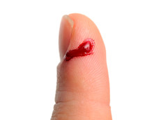 Aunque la saliva tiene propiedades sumamente atractivas, tampoco es una poción milagrosa. Decimos esto porque ante una cortadura, muchas personas tienen la costumbre de aplicar saliva en la herida, lo cual puede ser peligroso pues las bacterias de la boca pueden provocar una infección.