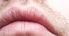 Los labios están cubiertos por una piel muy delgada que se irrita y agrieta fácilmente. Si están secos, se ven pálidos y agrietados. Esa palidez  puede deberse al frío,  hipoglucemia o una disminución del número de glóbulos rojos que induce a la anemia. Es importante conocer si tienes  otros síntomas que puedan indicar desde una avitaminosis, una deficiencia de ácido fólico o enfermedad primaria infecciosa. 