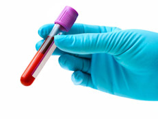 La hemofilia se presenta en uno de cada 5,000 nacimientos de varones en Estados Unidos, según datos de los Centros para el Control y Prevención de Enfermedades (CDC, por sus siglas en inglés) aproximadamente 20,000 personas presentan esta afección. La hemofilia afecta por igual a todas las razas o grupos étnicos. Las terapias empleadas están destinadas a reducir la tendencia hemorrágica de los pacientes.