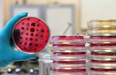 A medida que los gérmenes resistentes se desarrollan y se diseminan, la eficacia de los antibióticos disminuye. Este tipo de resistencia representa una amenaza muy grave para la salud pública y está aumentando en todo el mundo. Por eso, se necesitan estrategias antimicrobianas alternativas, lo que llevó a la reevaluación del uso de remedios antiguos, como la miel de Manuka: