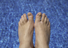 La aplicación de este aceite, a menudo junto con otros aceites esenciales, tanto en las uñas de las manos como de los pies, ayuda a eliminar las infecciones provocadas por hongos, manteniendo las áreas vulnerables libres de agentes dañinos. También existe evidencia sobre su efectividad para prevenir el pie de atleta e impulsar el proceso de curación.