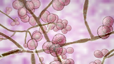 La candidiasis es una infección fúngica causada por cualquier hongo perteneciente al género Cándida. La más frecuente es la especie Candida Albicans. Si bien existen distintos tipos de candidiasis, aquí nos centraremos en la vaginal, sus causas, síntomas, modo de transmisión, tratamientos y consejos para prevenirla. 