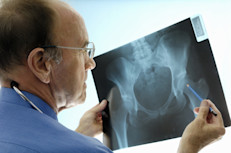 No hay un único examen para diagnosticar la osteoartritis. La mayoría de los doctores usan varios métodos, como la historia médica, exámenes físicos o de laboratorio o rayos X. Los tratamientos incluyen medicamentos, técnicas de alivio del dolor sin medicamentos, terapias complementarias y alternativas, y cirugía. También ayuda que comas o dejes de comer algunos alimentos. 