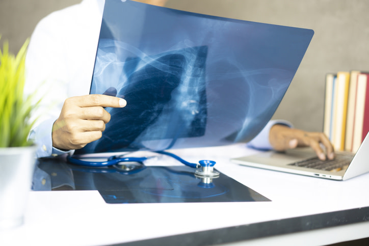 La neumonía es una infección que hace que los alvéolos de los pulmones se llenen de líquido o pus, dificultando así la respiración. Se estima que cada año es responsable del 15% de las muertes de menores de 5 años en el mundo. Actualmente, en el contexto de pandemia por coronavirus, su incidencia aumentó en toda la población. 