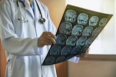 Actualmente, se desconoce cuál puede ser la causa de la prosopagnosia. Se la asoció con condiciones congénitas, traumatismos, derrames o enfermedades cerebrales. Muchos expertos coinciden en que podría deberse a lesiones en ciertas áreas (como vena emisaria, giro fusiforme o una parte del lóbulo temporal) que, en las personas sin prosopagnosia, se activan en respuesta a estímulos faciales.
