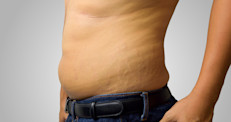 La flacidez es la pérdida de la tensión de la piel a causa de la degradación de las fibras de colágeno y elastina, que se encargan de dar tonicidad y firmeza a la cara y al cuerpo. Su localización más frecuente es en las zonas del rostro (papada y caída en ángulo mandibular o párpados), en la cara interna de los muslos, cara interna de los brazos, abdomen o los glúteos.