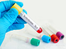Se define como los niveles de testosterona bioquímicamente bajos y que presentan un grupo de síntomas que pueden incluir disminución del deseo y  la actividad sexual, disminución de la erección espontánea, de la energía, y caen en depresión.