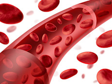 El principal tratamiento para la hemofilia es el tratamiento de restitución, de acuerdo con University of Maryland Medical Center. Consiste en la infusión o inyección intravenosa lenta de concentrados de factor de coagulación VIII (para la hemofilia A) o de factor de coagulación IX (para la hemofilia B). Estas infusiones corrigen la ausencia o deficiencia del factor de coagulación correspondiente.