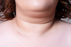 El colágeno y elastina son dos proteínas que trabajan en el cuerpo para darle firmeza y flexibilidad a la piel. El colágeno se localiza entre la epidermis y los músculos, y juega un papel muy importante a la hora de mantener la tersura de la piel y firmeza muscular, mientras que la elastina otorga elasticidad y ayuda a mantener la piel sana, suave, firme y flexible. Prueba estas opciones para obtenerlas: 