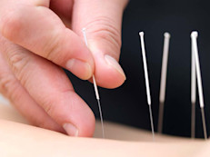 Basado en la creencia china de que el dolor es el resultado de lesiones o estrés que bloquean la energía vital, colocar las agujas o hacer presión se supone restaura el flujo de la energía vital. Algunas investigaciones sugieren que, como resultado de la acupuntura, el cerebro genera endorfinas, unas sustancias que reducen el dolor. No se ha probado que la acupuntura sea de ayuda con la hemofilia.