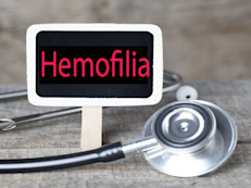 La hemofilia es una afección hemorrágica hereditaria en la que la sangre no coagula de manera adecuada. Quien la padece tiene poco o nada de factor de coagulación, o de  proteínas que junto a las plaquetas, ayudan a producir la coagulación normal de la sangre. En Estados Unidos se registran unos 400 casos anuales y  afecta a 1 de cada 5,000 bebés varones, según informan los Centros para el Control y Prevención de Enfermedades (CDC). 