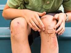 Las heridas superficiales y raspones pueden tratarse limpiando la zona y aplicando presión y bandas adhesivas. En caso de heridas profundas es necesario elevar el nivel de factor a 50% y realizar una sutura en un centro médico de emergencia. 