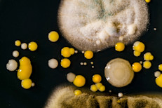 Existen millones de tipos de hongos, organismos primitivos que viven en el aire, suelo, plantas y agua a lo largo del planeta. También pueden vivir en el cuerpo humano. Suelen reproducirse mediante pequeñas esporas, que pueden ser inhaladas o caer sobre las personas, por lo que las infecciones suelen comenzar en los pulmones o en la piel.
