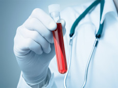 Puede ser otra manera de detectar enfermedades. Toda la sangre donada se prueba para el VIH, hepatitis B y C, sífilis y otras enfermedades infecciosas. Y al donante se le realiza un mini chequeo físico. Esto podría ayudarte a detectar problemas que tal vez desconocías.