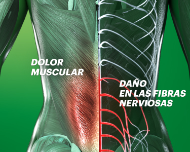 Cuerpo humano con detalle de daño en fibras nerviosas