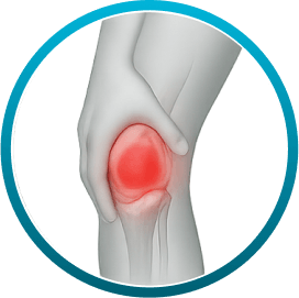 rodilla