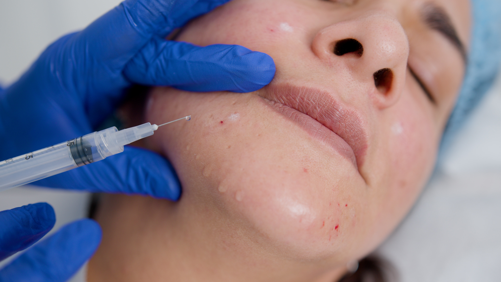 VTCT Level 6 Aesthetic Therapist