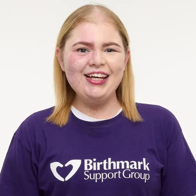 Concealing And Celebrating Birthmarks Your Way, With Amba