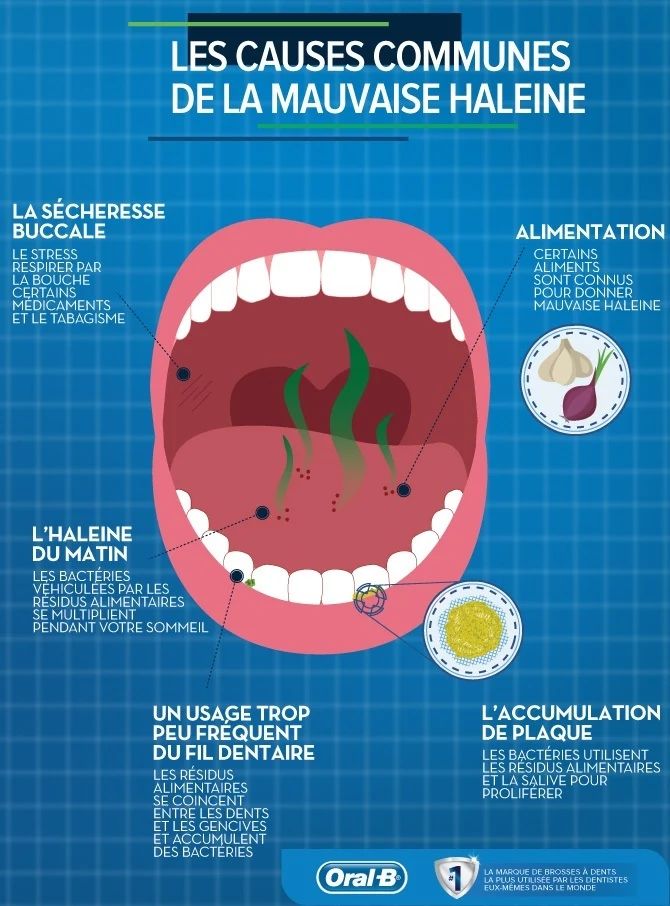 Mauvaise haleine (halitose) : Causes, remèdes et traitements