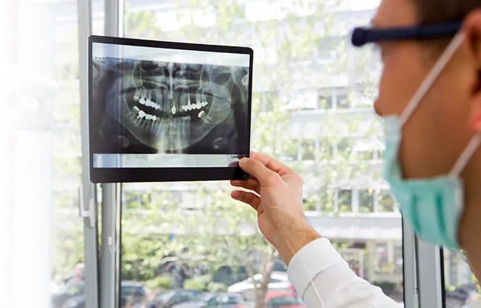 Qu’est-ce qu’une carie et qu’est-ce qui cause la dégradation des dents?
