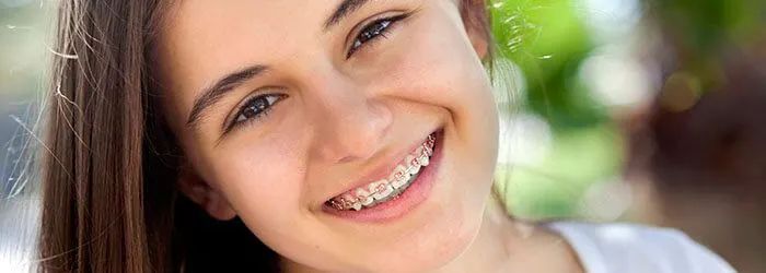 Questions sur les appareils orthodontiques