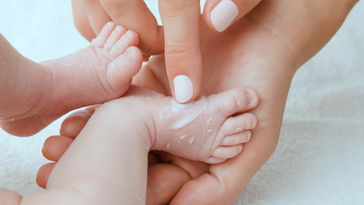 Neurodermitis bei Babys-Hautpflege-creme