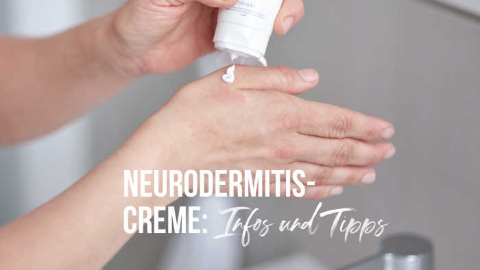 Neurodermitis-Creme wird auf weibliche Hand aufgetragen