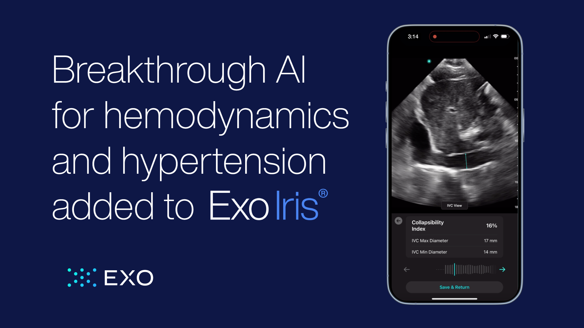 Breakthrough AI for hemodynamics and hypertension added to Exo Iris®. 