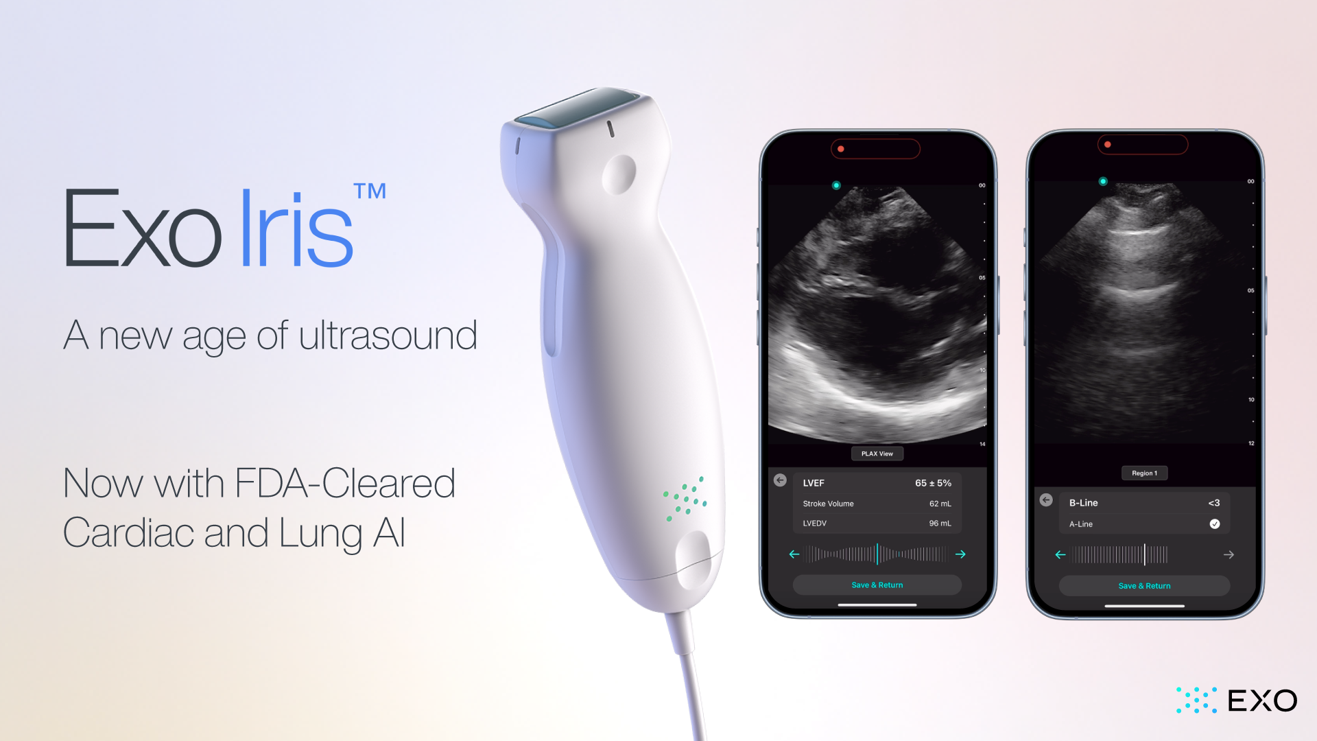 Exo® (pronounced “echo”), a medical imaging software and devices company, today announced its FDA-cleared cardiac and lung artificial intelligence (AI) applications are now available on Exo Iris™, Exo’s high-performance handheld ultrasound device. 